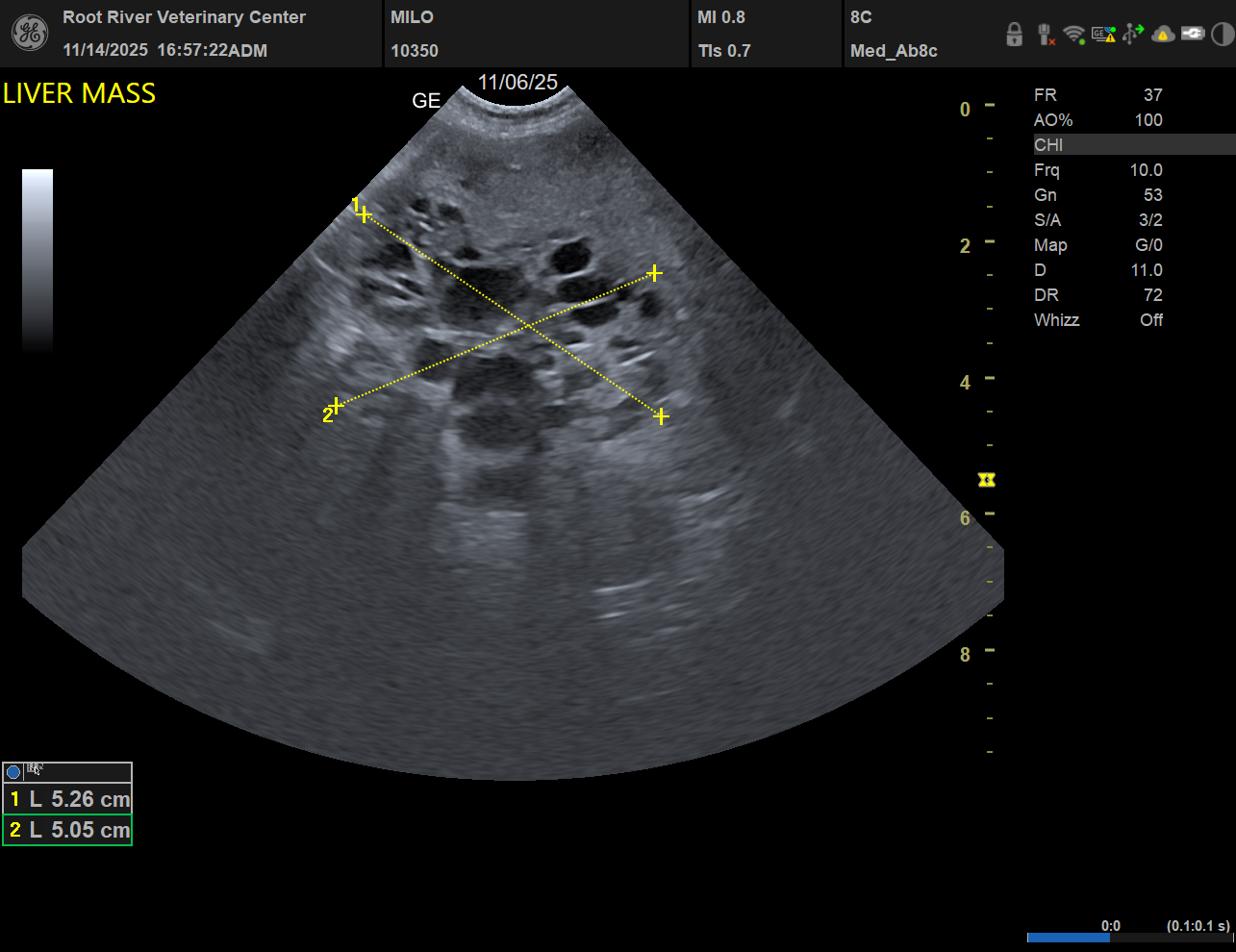 Ultrasound of Milo's liver mass