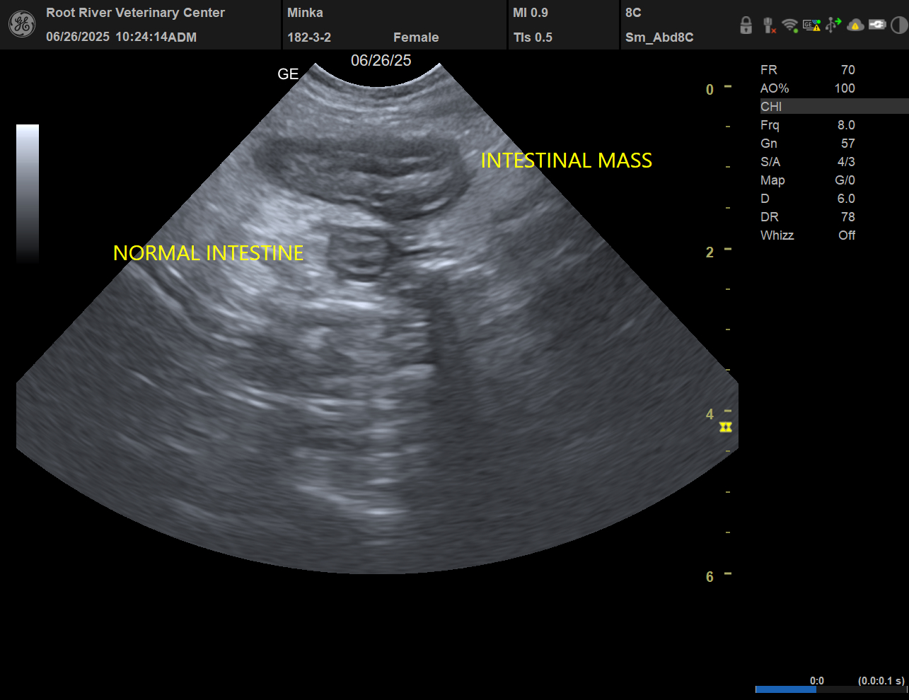 An ultrasound of a intestinal mass