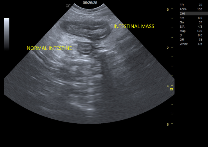 x-ray of an internal mass